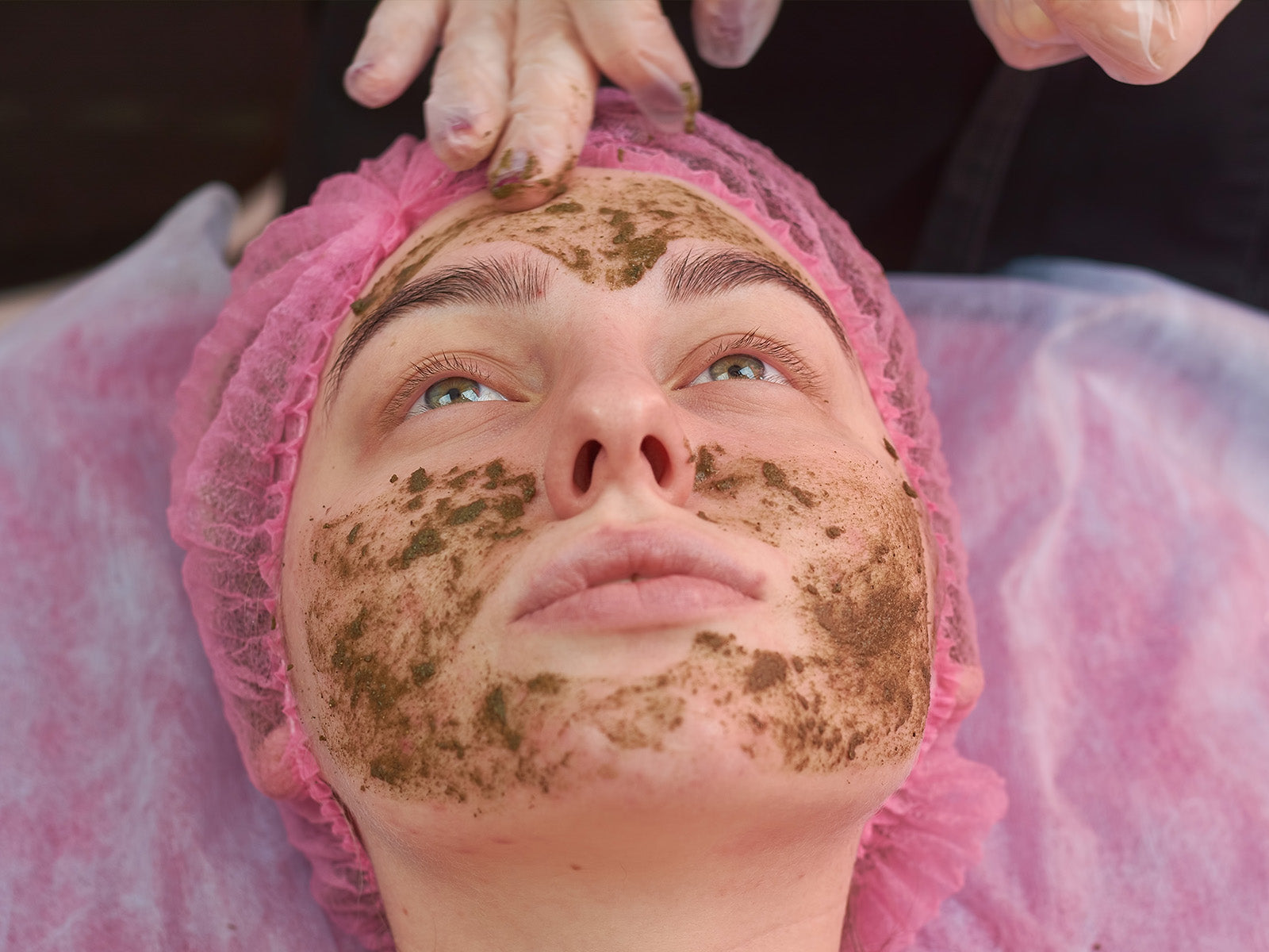 Everything You Need to Know About Skin Peels (B Peel & C Peel)